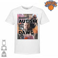 You Call It Autism I Call It Having That Dawg In Me Meme shirt